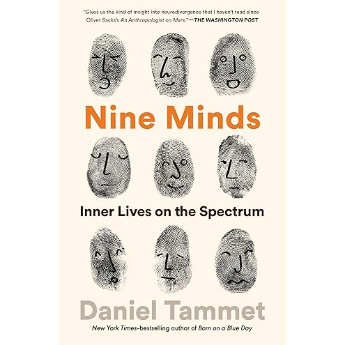 This Is My Brain in Love