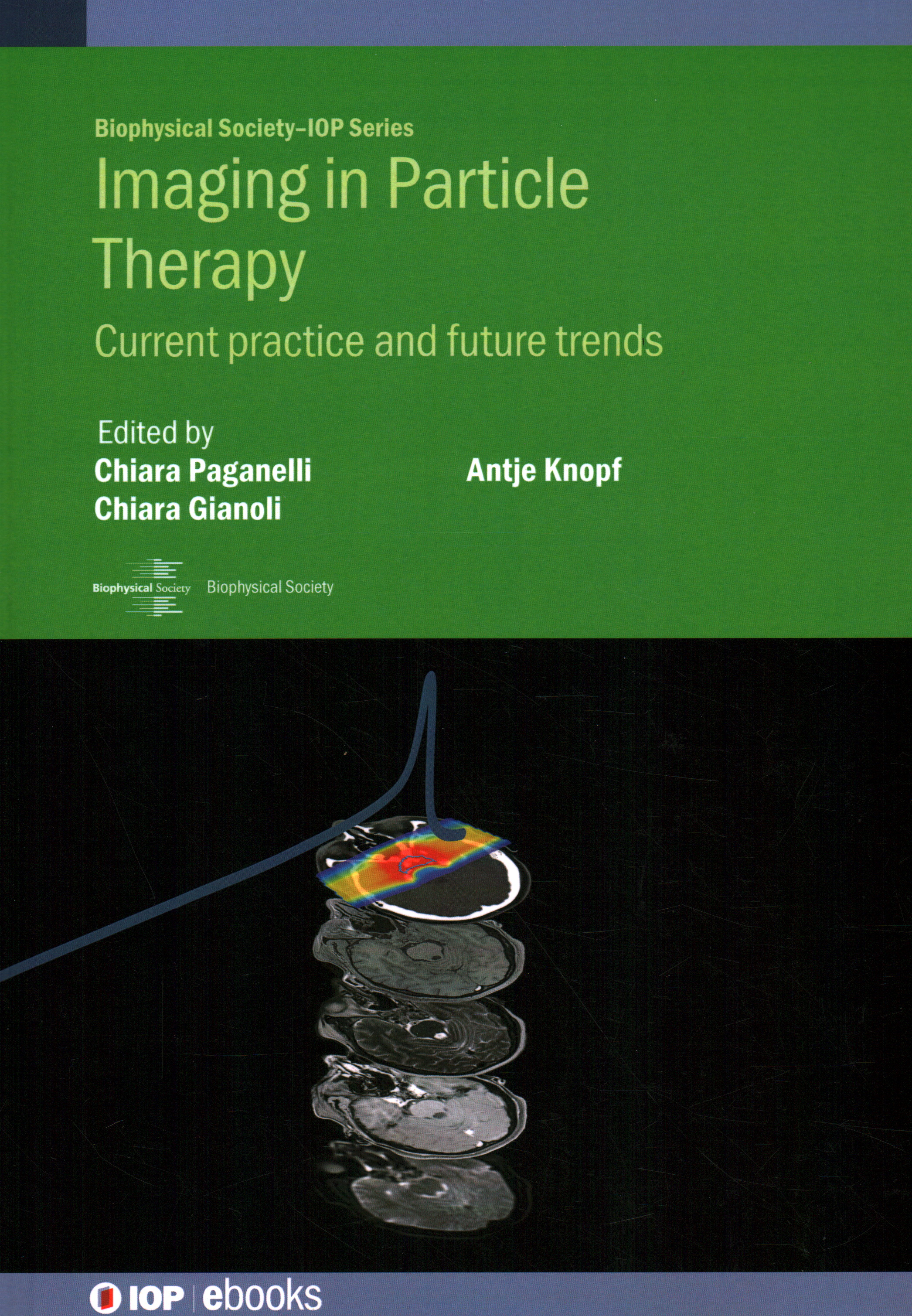 Imaging in Particle Therapy by Chiara Paganelli