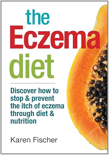 The Eczema Diet by Karen Fischer