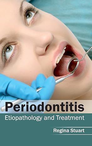 Periodontitis: Etiopathology and Treatment by Regina Stuart
